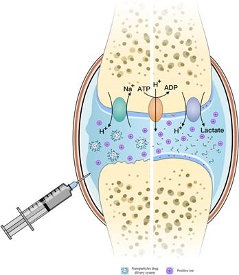 Advancements in pH-Responsive nanoparticles for osteoarthritis treatment: Opportunities and challenges